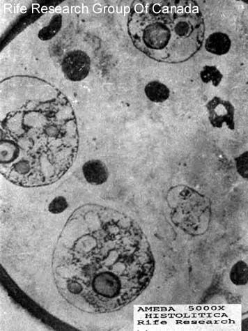 Entamoeba histolytica (amoeba) 5000x