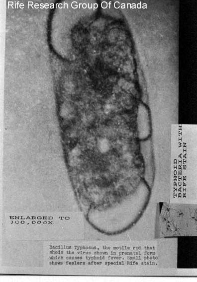 Typhoid Bacteria with Rife Stain Enlarged to 300,000x