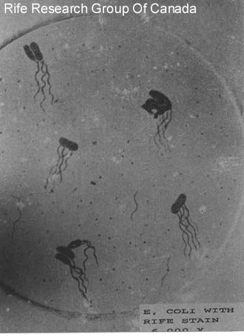 Escherichia coli with Rife Stain 6000x