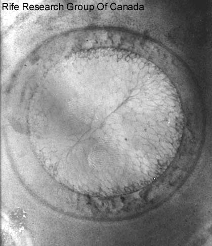 Clostridium tetani (tetanus) spore