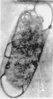 Typhoid Bacillus (The Universal Microscope). 22,000X on 35mm film, enlarged 300,000X